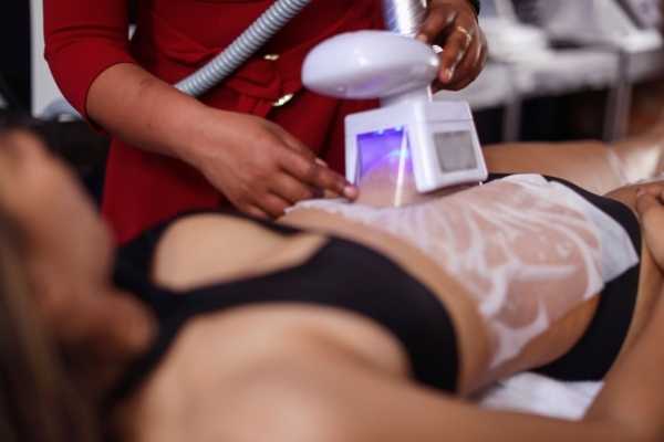 Get Your Dream Body with Non-Invasive Fat Freezing Marlborough