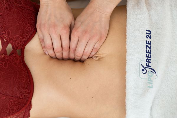 diastasis recti treatment Marlborough