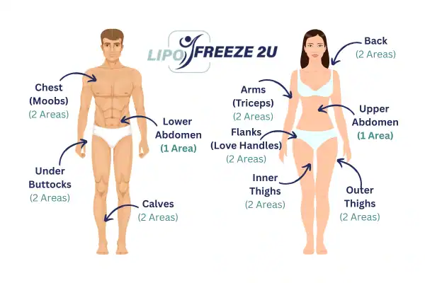 Areas you can have fat freezing treatment Marlborough