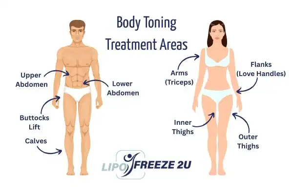 Graphic showing where you can have Body toning Treatment Marlborough on your body